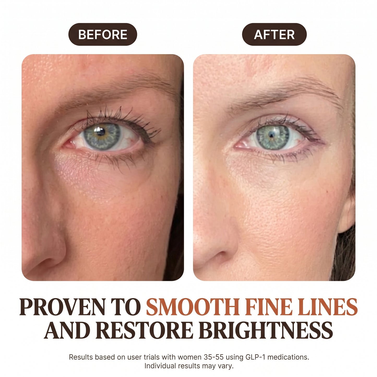Peptide Recovery Eye Cream (0.51 fl oz)