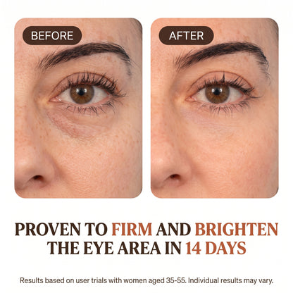 Peptide Recovery Eye Cream (0.51 fl oz)