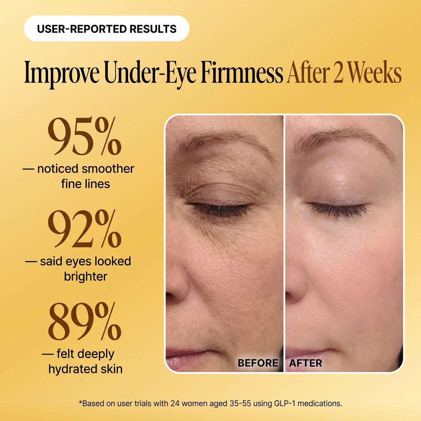 Peptide Recovery Eye Cream (0.51 fl oz)